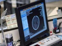 Salute, Padovani (Sin): “Longevità aumenta rischio Alzheimer, agire su prevenzione”