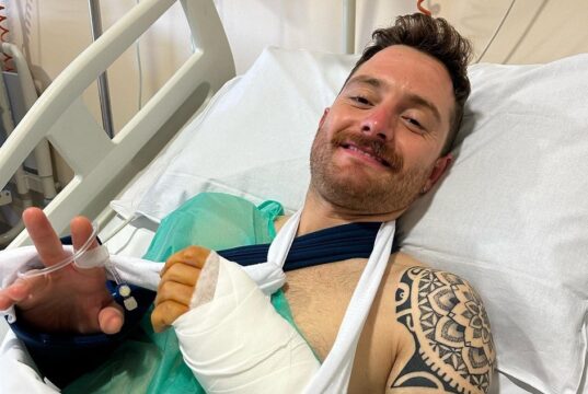 Simone Consonni operato allo scafoide dopo l’incidente