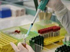 Cancro pancreas, svelati alcuni meccanismi chiave all’origine: la scoperta tutta italiana