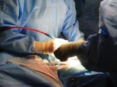 Trapianto di fegato completamente robotico, a Padova la prima mondiale con tecnica innovativa