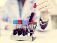 Come vivere più a lungo? Il test del sangue svela la longevità