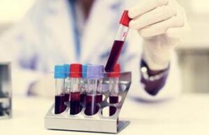 Come vivere più a lungo? Il test del sangue svela la longevità