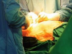 Asportato tumore di 5 chili, intervento all’ospedale di Mazara del Vallo