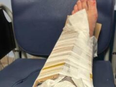 Frattura steccata con il cartone, rimossa responsabile Pronto Soccorso