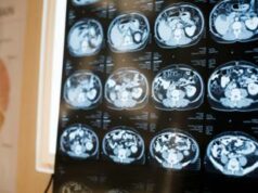 Dopo lesione parte del cervello si addormenta: “Svegliarla si può”