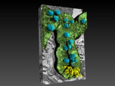 Rivelato il legame intestino-cervello nell’Alzheimer grazie ai raggi X