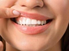 Denti a rischio tra i giovani, Sidp: “Il 36% della Gen Z ha gengive che sanguinano”