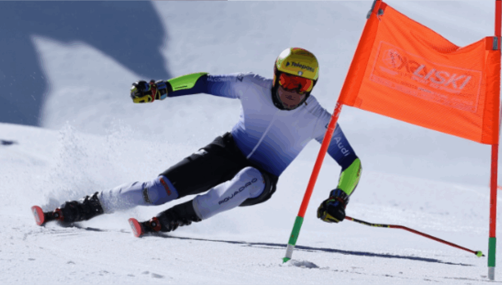 Mattia Casse