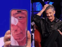 Fiorello, l’incidente in bicicletta: “Volevo fare il figo… sono caduto di faccia”