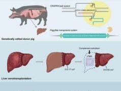 In Cina primo trapianto al mondo di fegato maiale-uomo, ha funzionato per un mese