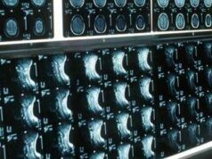 Ipofosfatemia legata all’X, primo bilancio e prospettive su linee guida