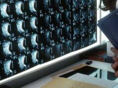 Oltre 500 malattie rare delle ossa, esperti: “Investire in prevenzione e diagnosi”