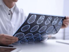 Salute, psicologa Borghi: “Oltre la sclerosi multipla un percorso verso il futuro”