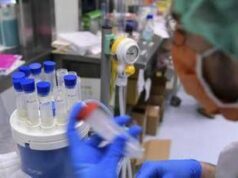 Legionella, a Milano sospetto focolaio: 11 casi con 1 morto in zona San Siro