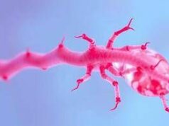 Miastenia, in Sardegna su mille pazienti stimati solo metà nel registro