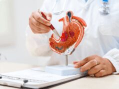 Tumore allo stomaco, pazienti: “Diagnosi precoce per meno di 1 su 5, migliorare percorsi”