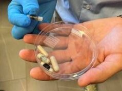Una capsula-cerotto per guarire le ulcere intestinali: ecco come funziona