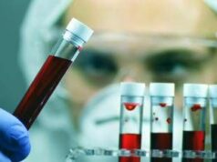 Leucemia linfatica cronica, con zanubrutinib sopravvivenza al 74% a 6 anni