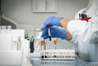 Alzheimer, test del sangue possono prevedere l’inizio dei sintomi