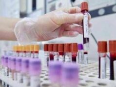 Allarme oncologi: “- 50% trial in Europa in 10 anni mentre Cina accelera”