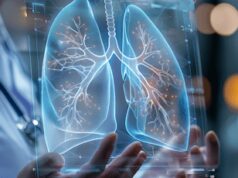 Cancro aggressivo al polmone, con mix di farmaci biologici raddoppia efficacia senza chemio