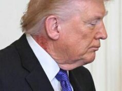 Trump e il collo arrossato, la foto riaccende i dubbi sulla salute del presidente