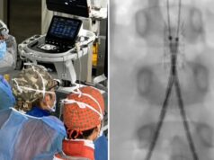 Incidente con un’acquasantiera in chiesa, bimba di 6 anni operata d’urgenza all’aorta a Bari