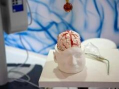 Dai gliomi al Parkinson, così l’intelligenza artificiale aiuta la Neurochirurgia