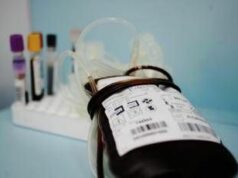 Emergenza sangue in Italia, chi può donarlo e ogni quanto