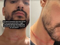 Mr. Daniel, il make-up artist dei vip, aggredito e rapinato a Milano: il racconto choc sui social