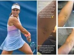 US Open, Stefanini e il livido sul braccio: “Colpa di un controllo antidoping…”