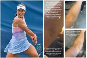 US Open, Stefanini e il livido sul braccio: “Colpa di un controllo antidoping…”